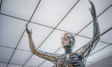 What is Foreign Language Syndrome?