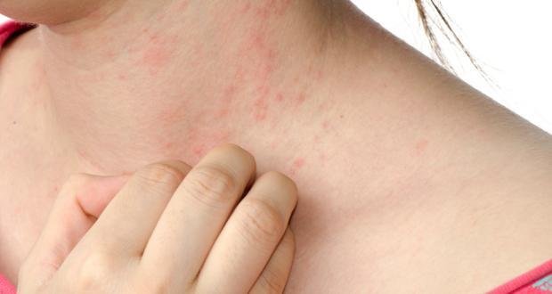 itchy skin