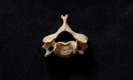 Causes and treatment of cervical incompetence